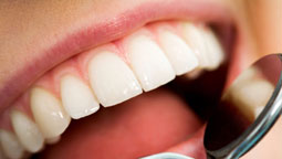 Cosmetic Dentistry