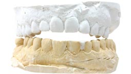 Full Mouth Reconstruction