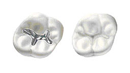 Metal Free Dentistry